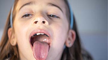 What 25 Years in Pediatric Dentistry Taught Me About the Tongue