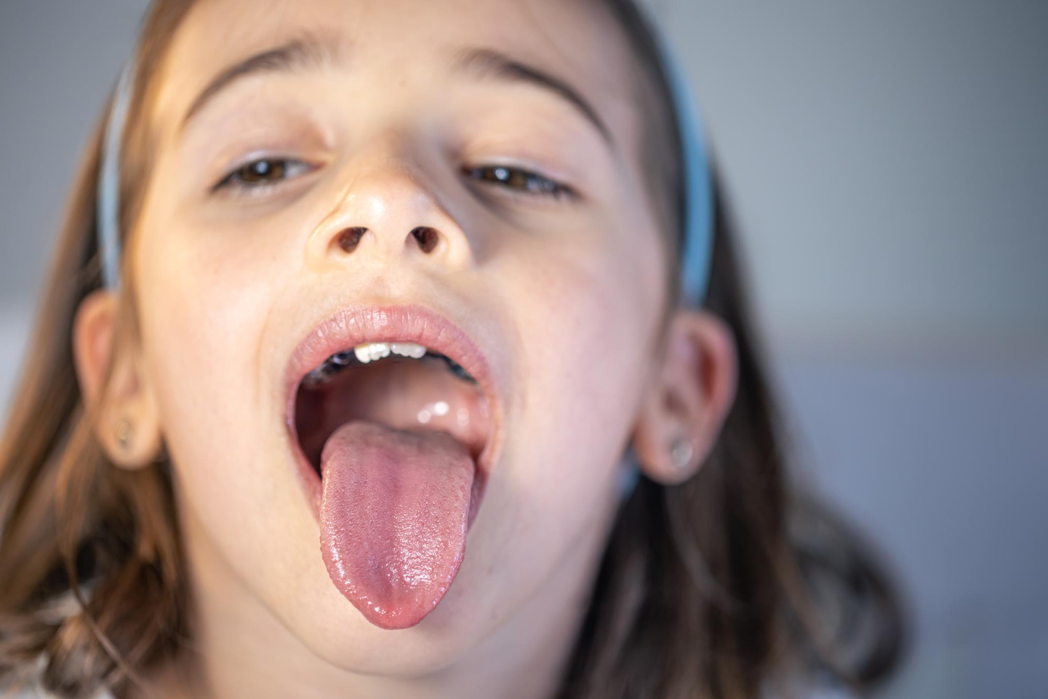 What 25 Years in Pediatric Dentistry Taught Me About the Tongue